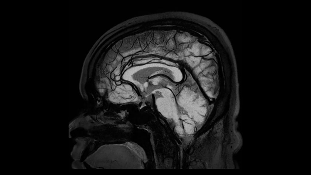 3D BrainView BB MSDE