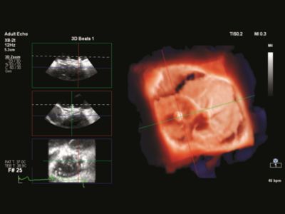 EPIQ CVx | Philips Healthcare