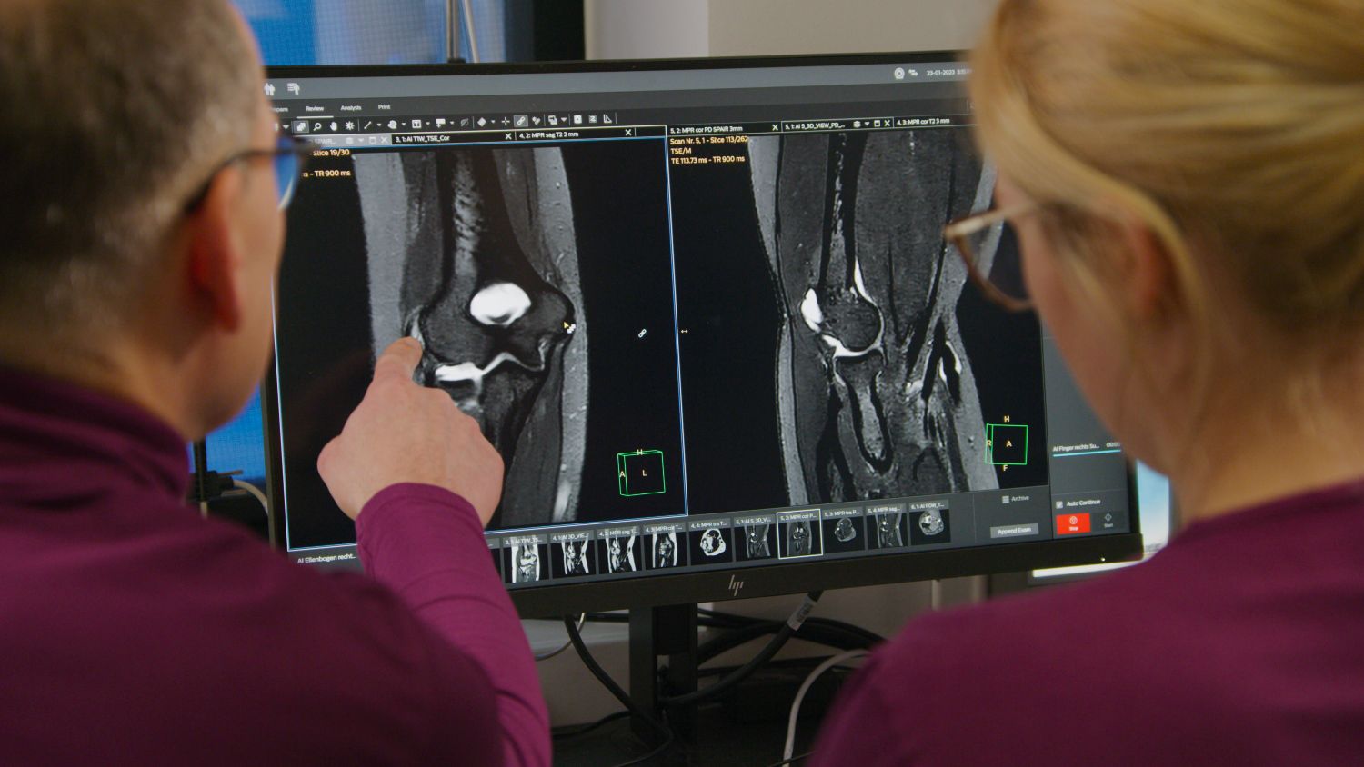 Radiologist and technologist looking at MRI images on screen