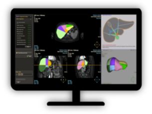 MR Liver Health Automated MR liver assessment