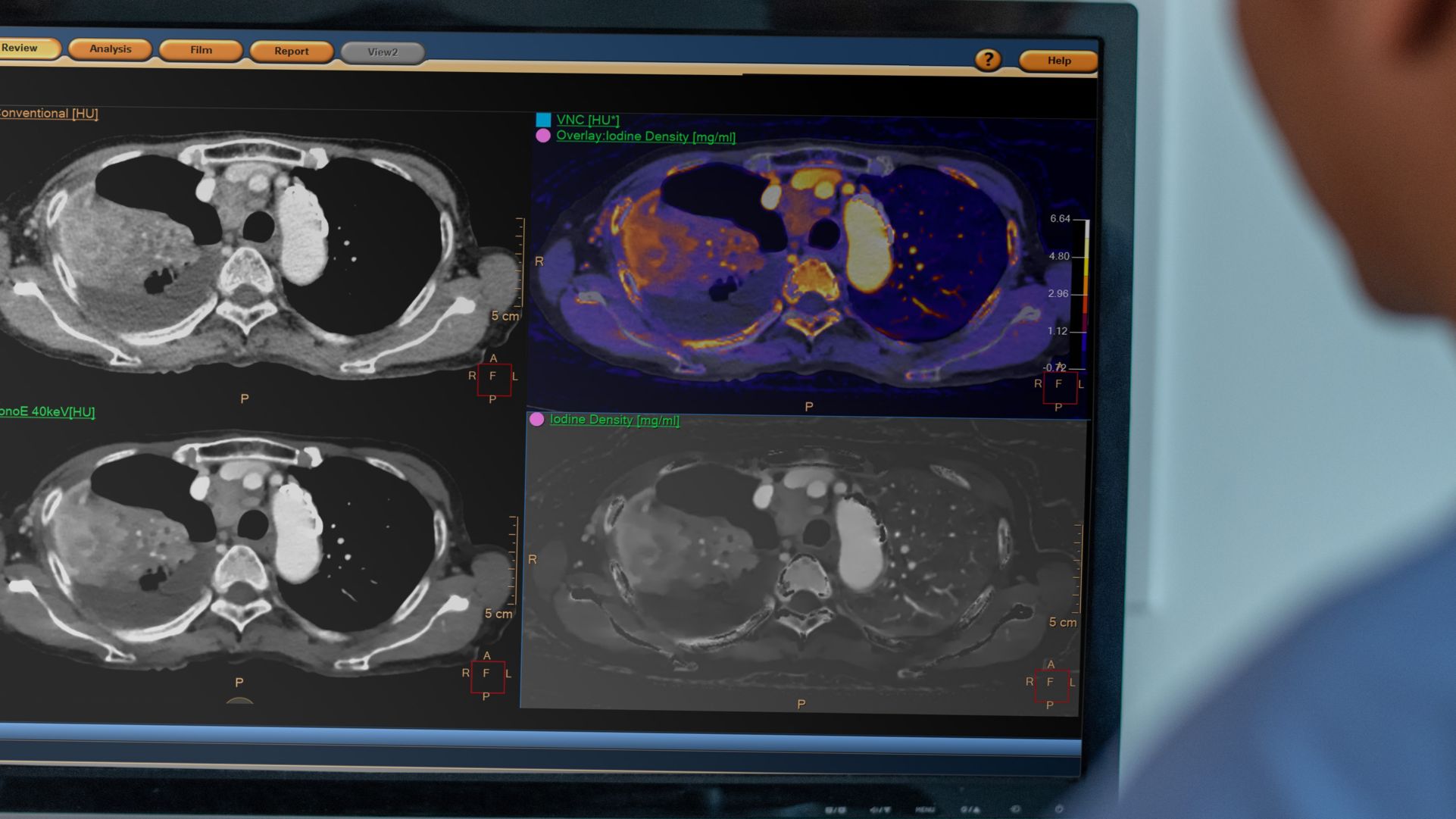 ct tech looking at scan