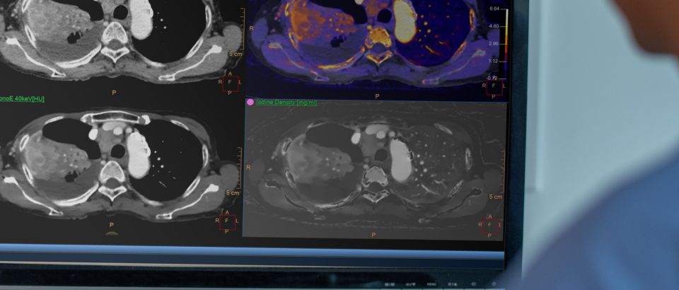 ct-technoloog die kijkt naar een scan