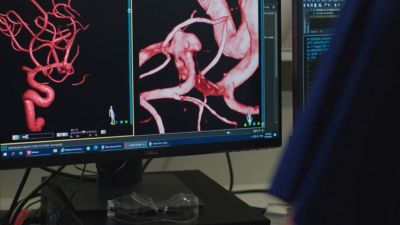 Image Guided Surgery