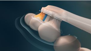 Automatically adjusts based on your brushing behavior