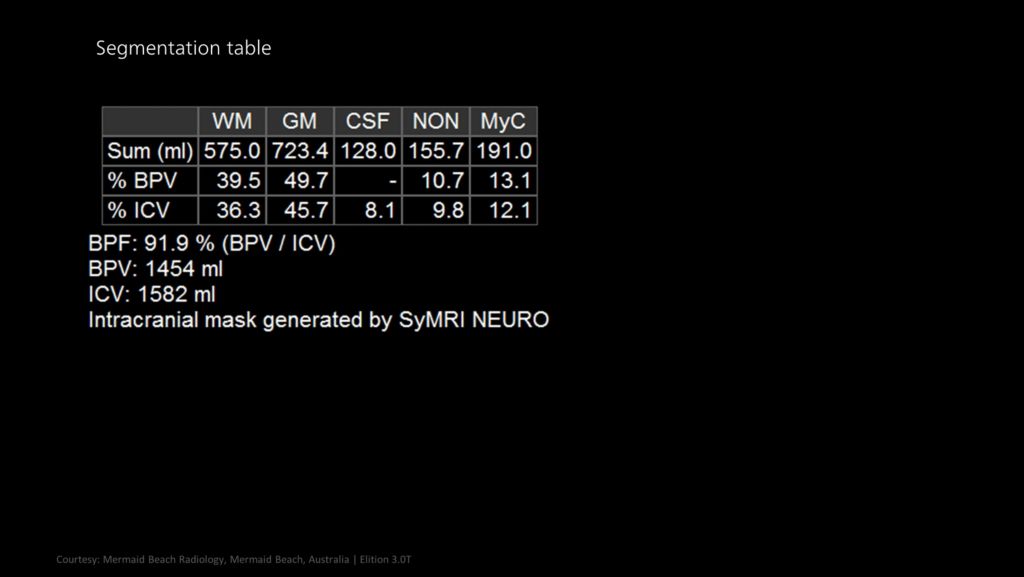 Segmentation table
