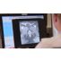 The future of MRI in radiotherapy UMCU thumbnail