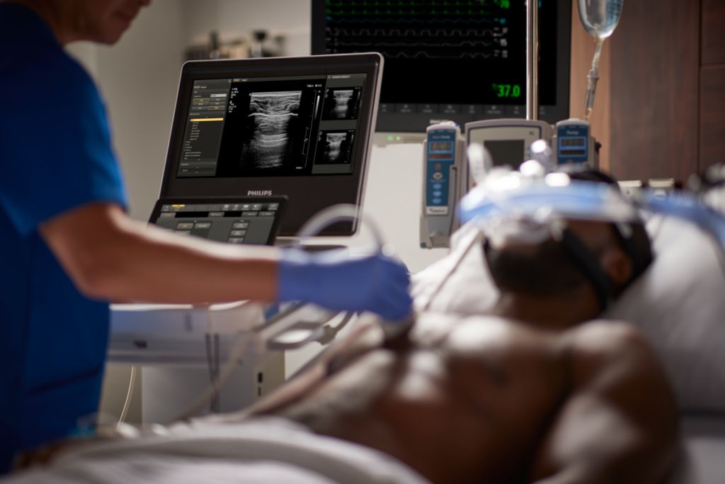 Compact Ultrasound System 5000 series for GI w/eL18-4 Transducer