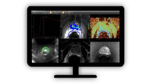 DynaCAD Prostate 