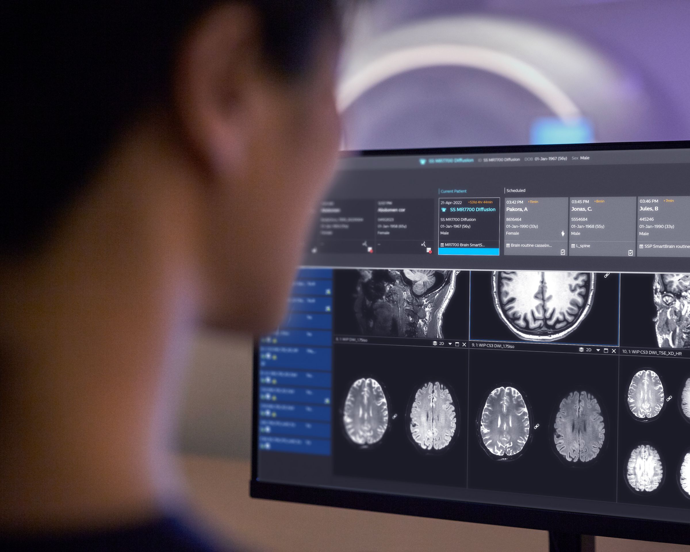 Technologist sitting behind the MR console reviewing the daily schedule for scanning patients