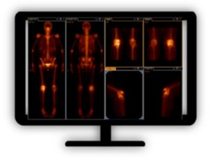 NM Suite Streamline Molecular Imaging workflow