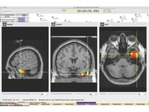 GeoSource 2 clinical ESI software EEG source imaging software