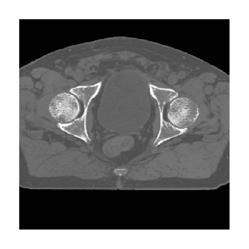 Onesite web image MRCAT pelvis