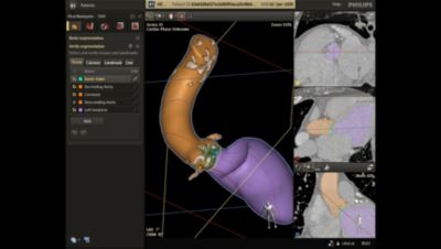 HeartNavigator Philips