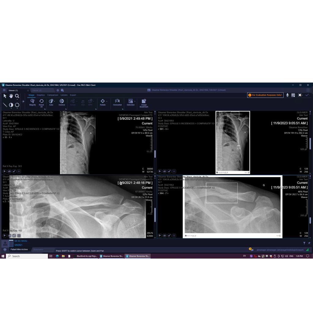  clinical image