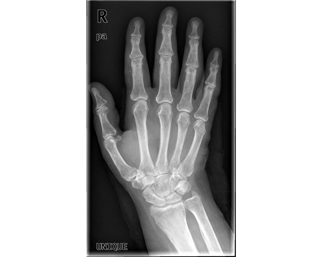 Unique X-ray image Processing Software