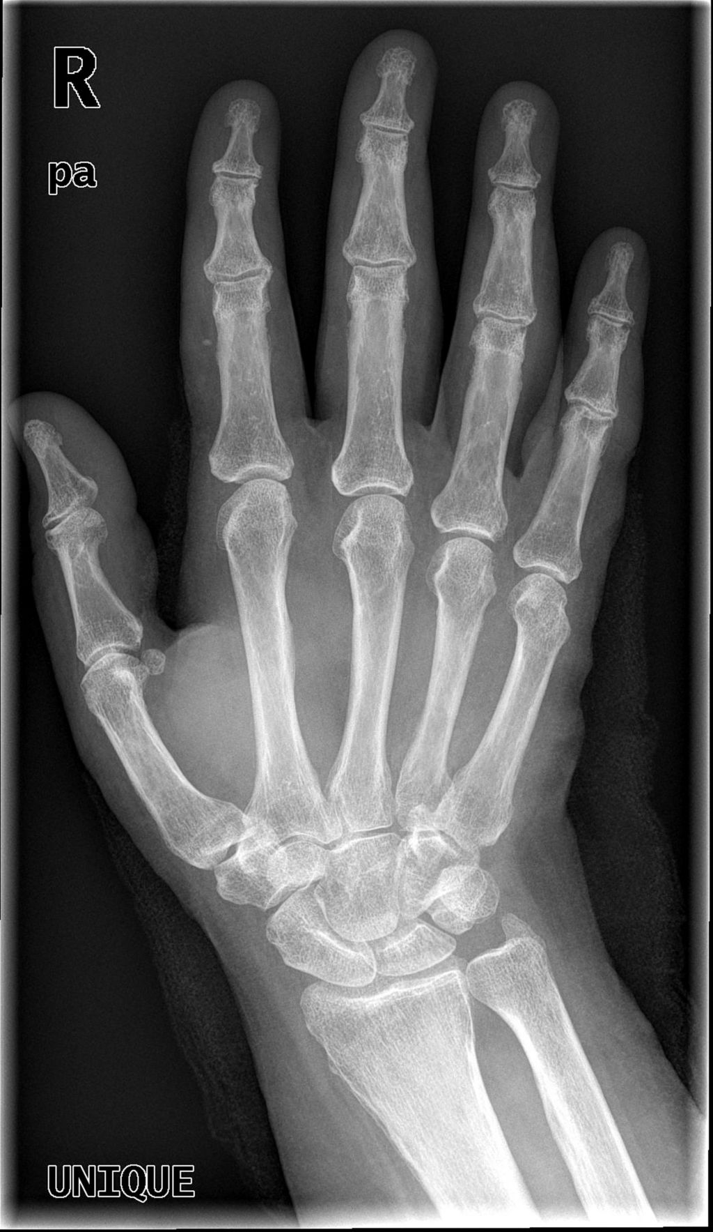 Unique X-ray image Processing Software