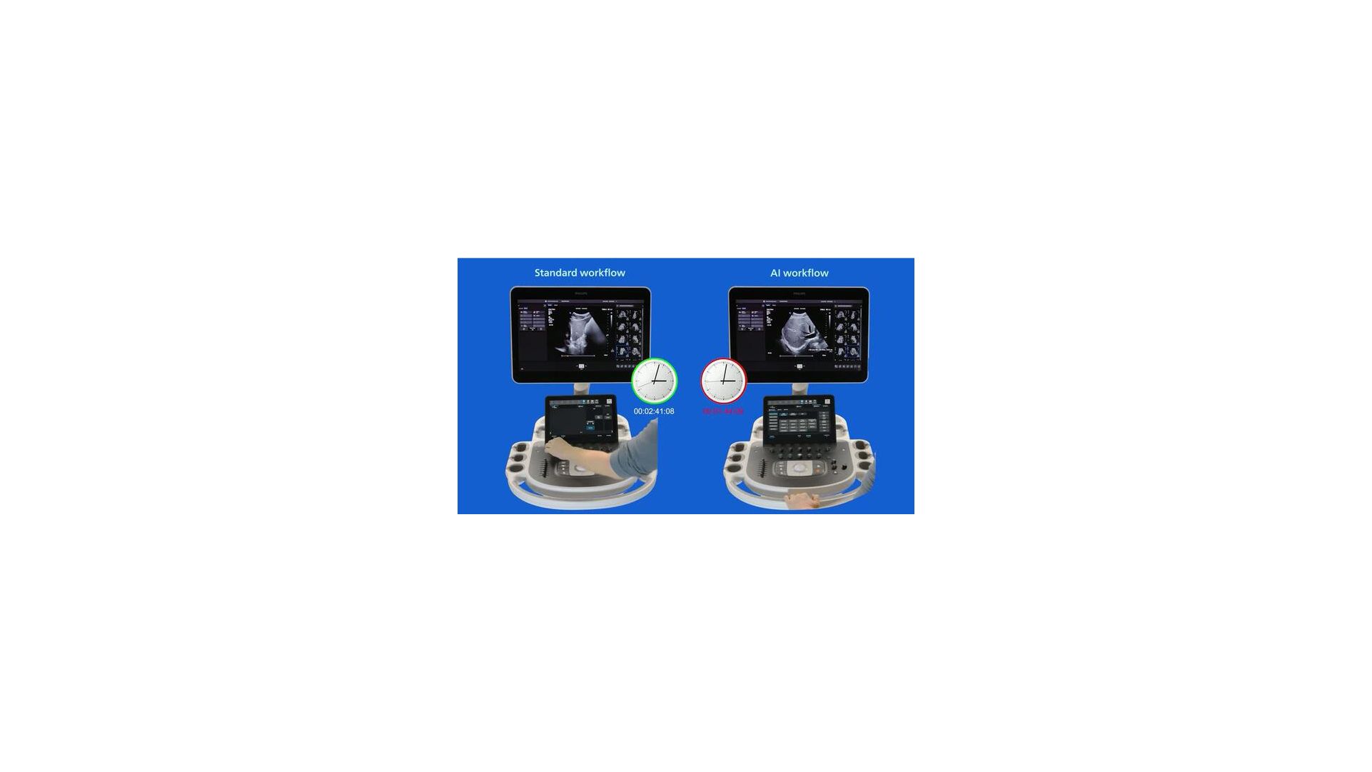 Side-by-side comparison of standard workflow and Auto Measure Abdomen workflow on an ultrasound system 