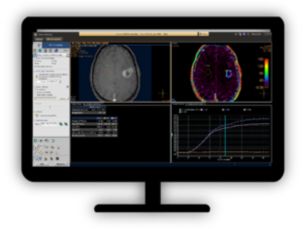 MR Permeability​ Lesion characterization by reviewing vascular leakage