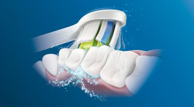 Napredna sonična tehnologija Philips Sonicare
