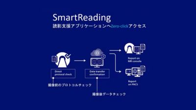 SmartReadingゼロクリックワークフロー図