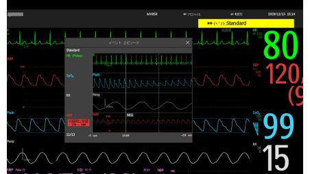 Optimisation de la gestion des alarmes