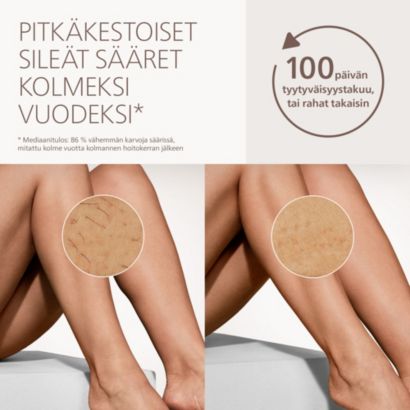 Philips Lumea IPL 7000