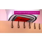 The ideal way to prevent hair regrowth