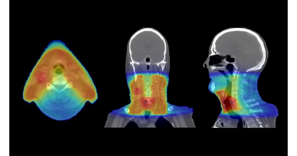 Accuracy in dose planning