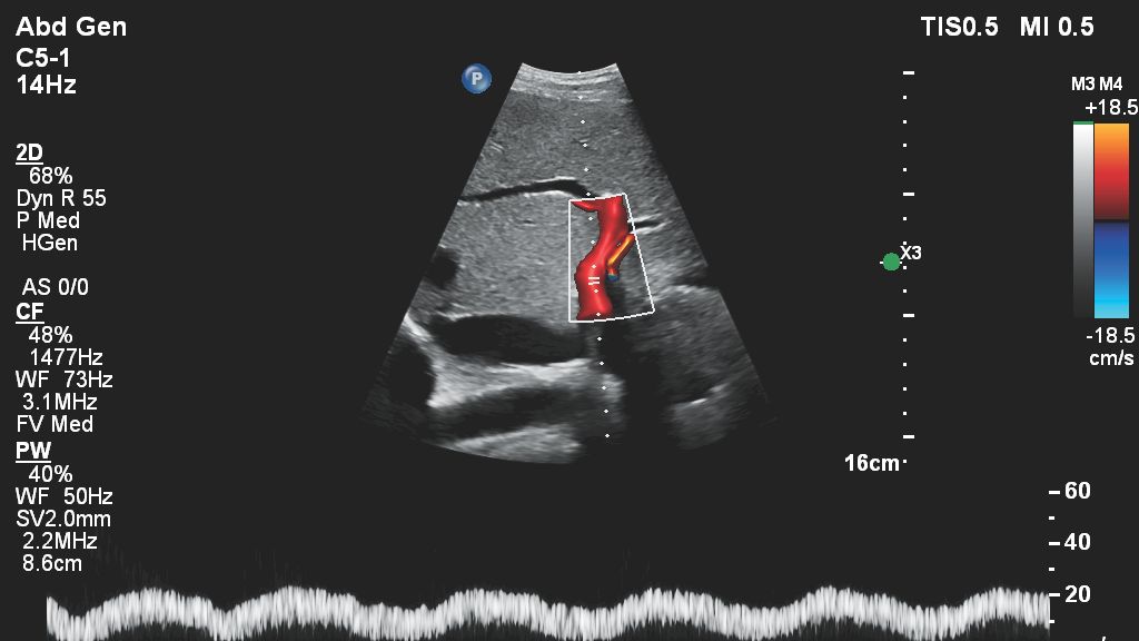 Femoral vein