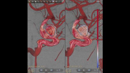 Relevant information about blood vessel flow