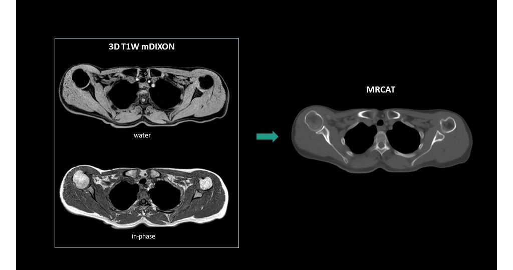 MRCAT generation based on single mDIXON source scan
