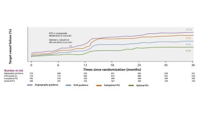 ULTIMATE RCT Target Vessel Failure