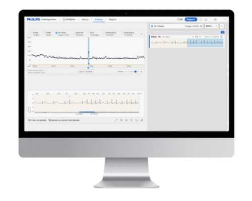 View of Cardiologs Holter platform on a computer screen