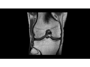 SmartSpeed Precise - MSK MR Clinical Applications