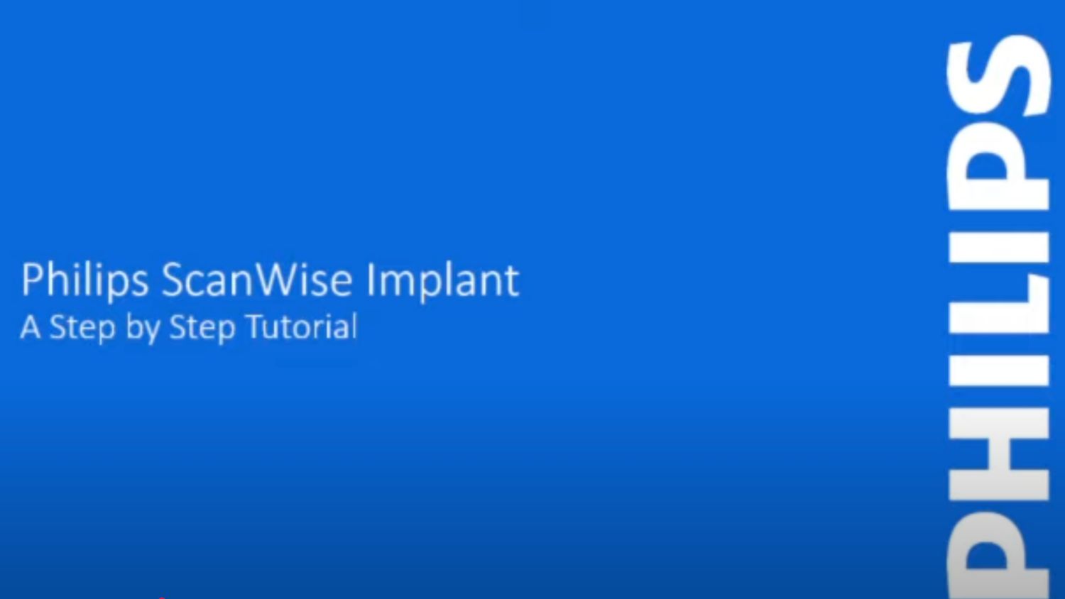 ScanWise Implant video tutorial