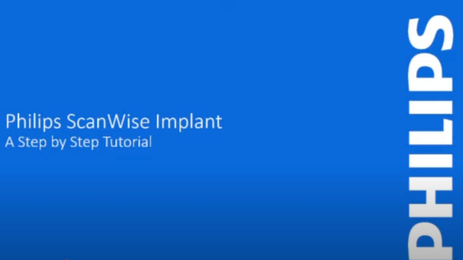 ScanWise Implant video tutorial