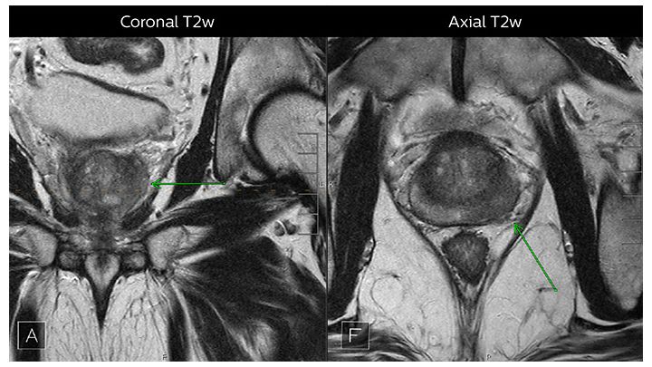 View of Axial and Coronal