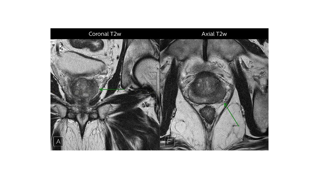 Dr. Steiner Article MR Coronal vs Axial