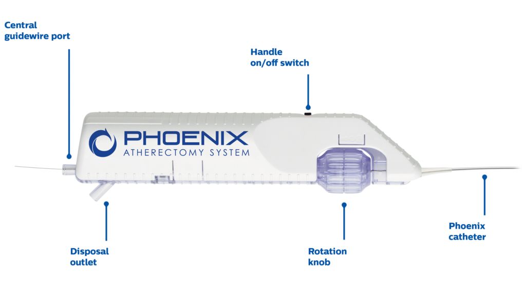Phoenix is single insertion with no need to remove and clean out debulked material. It is battery-powered and handle-operated. No capital equipment or additional procedural accessories are required. A low profile, front-cutting design allows for direct lesion access without having to first pass a nosecone. 
