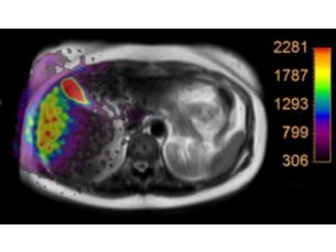 Multi Nuclei - Abdomen Seamless integration of Multi Nuclei