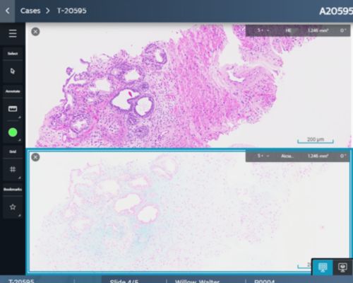 Pathology clinical image
