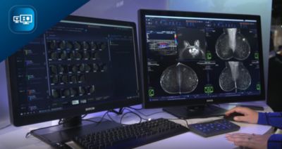 Breast 第2版 Imaging Diagnostic