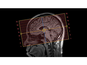 SmartExam Brain Клиническое приложение для МР-исследований