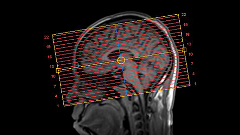 SmartExam Brain Zastosowania kliniczne obrazowania MR