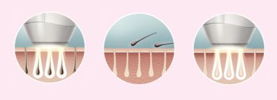 Enjoy smooth skin every day