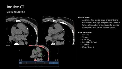 Incisive Ct Ct Scanner Philips Healthcare