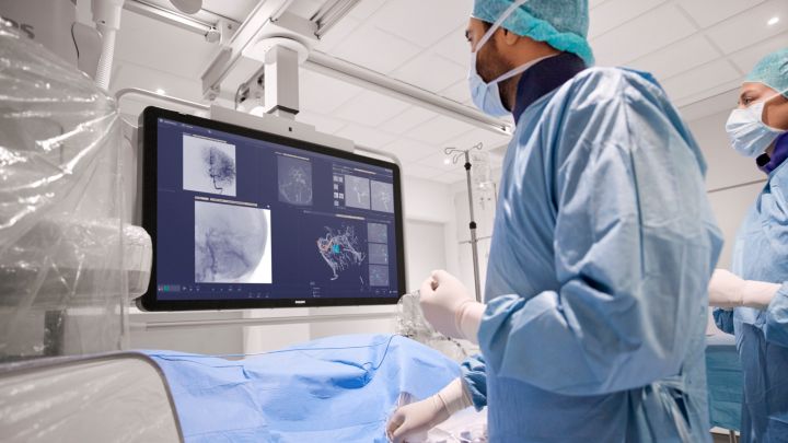 Neurovascular treatment for AVMs and AVFs