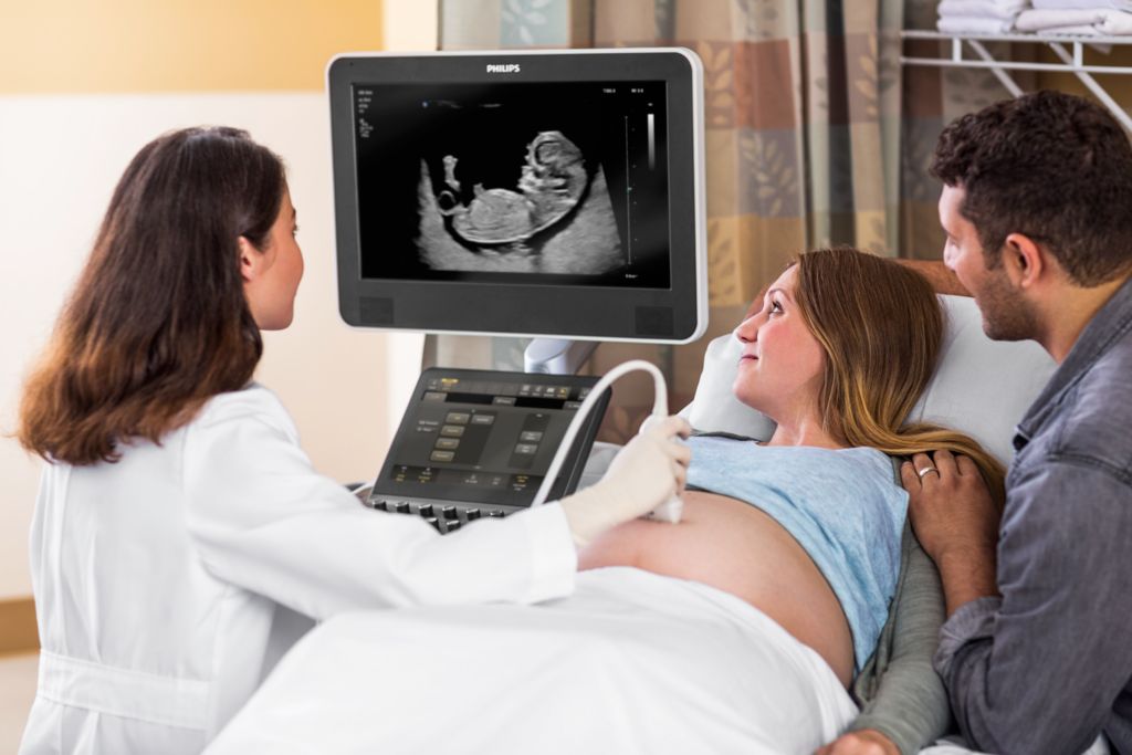 Ultrasound OB TDP Scan with eL18-4 Transducer
