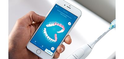 State-of-the-art 3D mouth-map