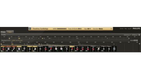 Panoramic, chronological overview of your patients